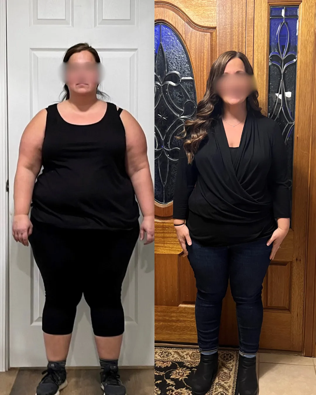 Before After 3